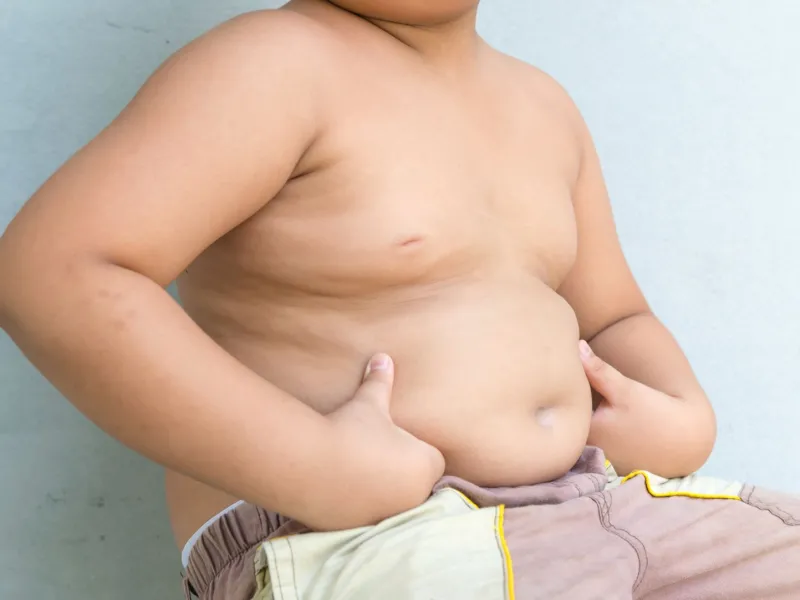 Obesidad: la punta de un iceberg sanitario que urge abordar